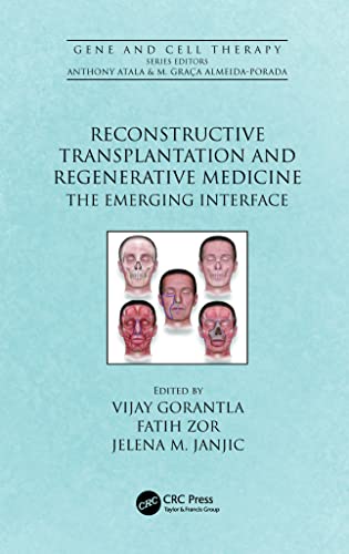 Reconstructive Transplantation and Regenerative Medicine: The Emerging Interface