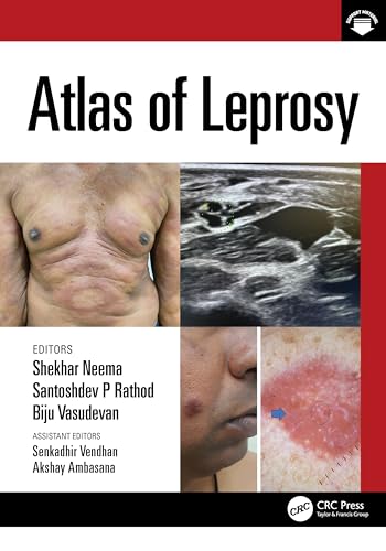 Atlas of Leprosy – Book Cover