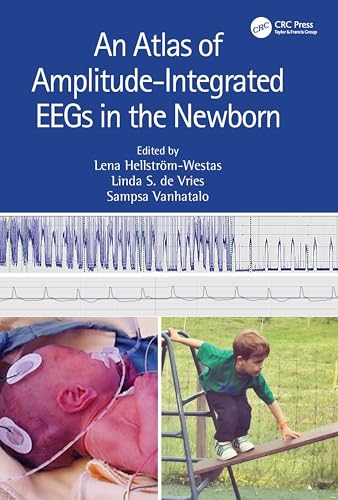 An Atlas of Amplitude-Integrated EEGs in the Newborn – Book Cover