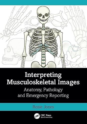 Interpreting Musculoskeletal Images: Anatomy, Pathology and Emergency Reporting