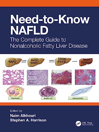 Need-to-Know NAFLD: The Complete Guide to Non-Alcoholic Fatty Liver Disease