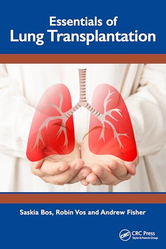 Essentials of Lung Transplantation – Book Cover