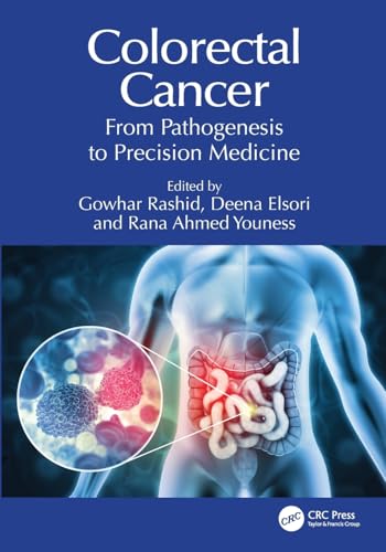 Colorectal Cancer – Book Cover