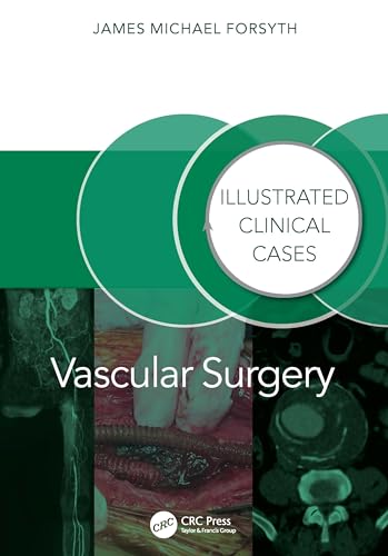 Vascular Surgery: