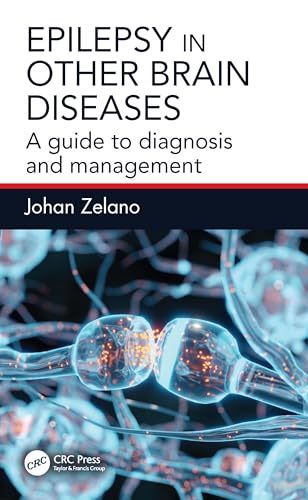 Epilepsy in Other Brain Diseases – Book Cover