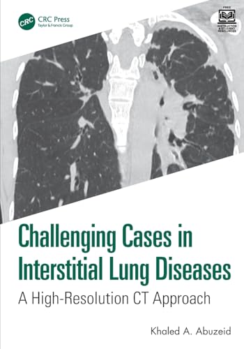 Challenging Cases in Interstitial Lung Diseases – Book Cover