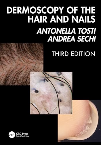 Dermoscopy of the Hair and Nails 3e – Book Cover